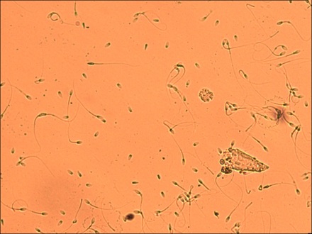 Embriovet Inseminação Artificial